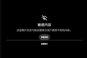 露骨！慎入！范德彪小拇指的骨頭直接刺出來了！
